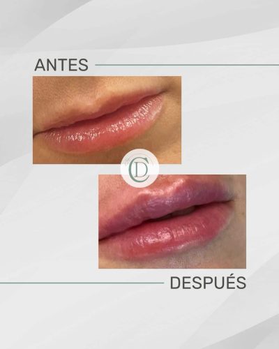 labios1